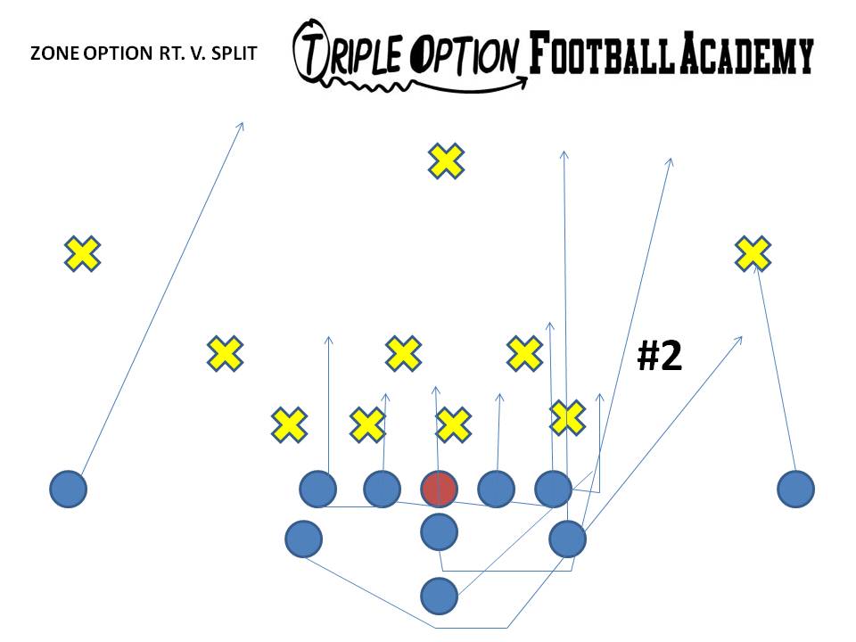 ZONE OPTION RT V SPLIT