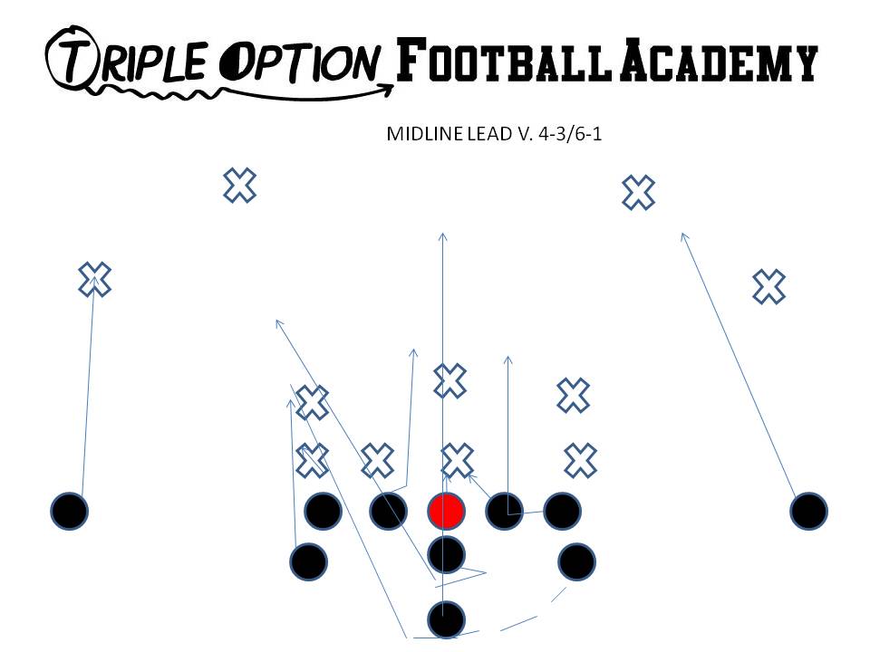 MIDLINE LEAD V 43